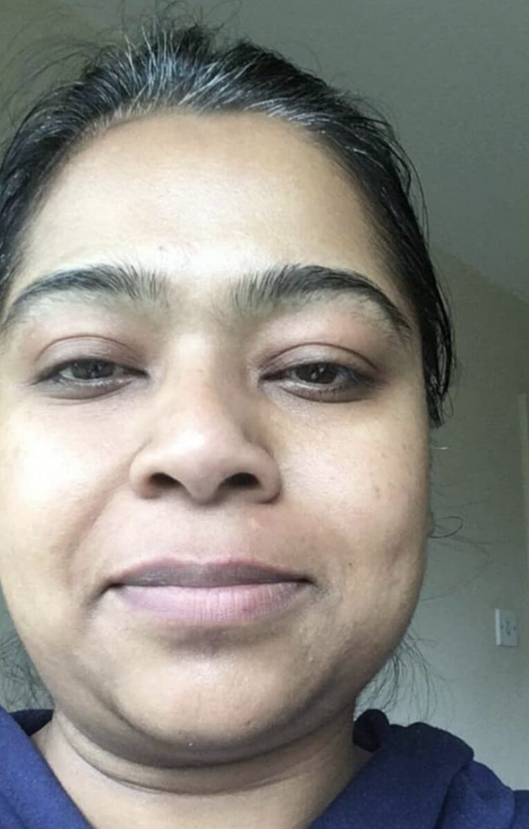 before chemical peel