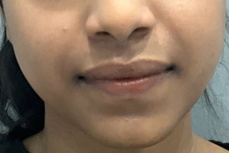 After