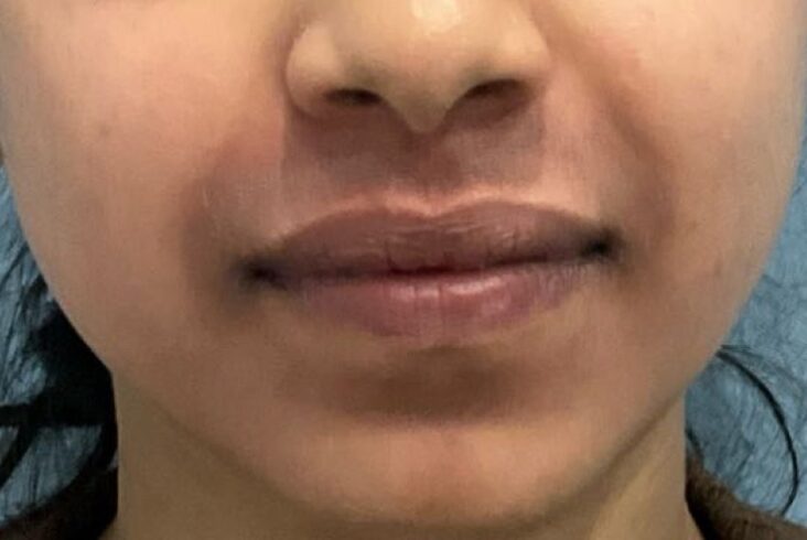 Before