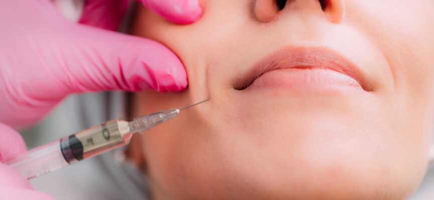 Dermal fillers 1