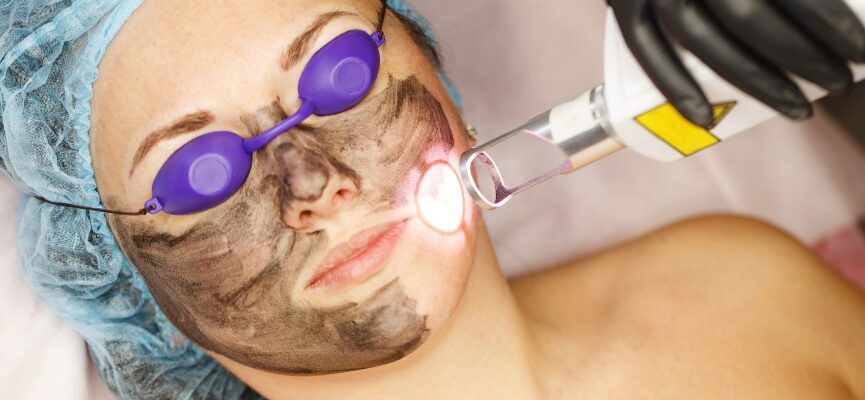 Laser Treatment 1