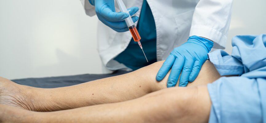 Platelet rich plasma therapy 1