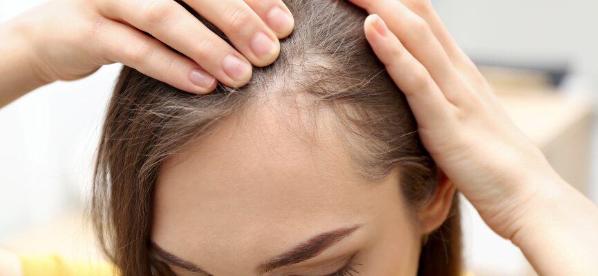 Restore Hair Loss 1