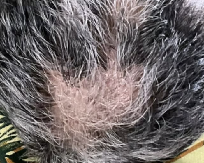 alopecia before