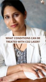 ✨ Discover the incredible benefits of CO2 laser technology for treating a variety of skin conditions! ✨

CO2 laser is not just about skin rejuvenation; it’s a versatile treatment that addresses multiple concerns. Whether you're looking to revitalise lax skin around the eyes or smooth out acne scars, this advanced technology provides effective solutions.

It’s also ideal for safely removing benign moles and lesions, ensuring a clearer complexion. If you have small skin tags, particularly on darker skin (often referred to as DPNs), CO2 laser treatment is an excellent option for removal. Additionally, this powerful laser can effectively target seborrheic keratosis, which are harmless warts that may appear on the face or back.

Say goodbye to unwanted skin imperfections and hello to a more confident you!

#CO2Laser #SkinRejuvenation #AcneScars #SkinTags #Dermatology #SeborrheicKeratosis #HealthySkin #SkinCareSolutions
